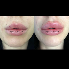 Load image into Gallery viewer, Lavo Lip Booster