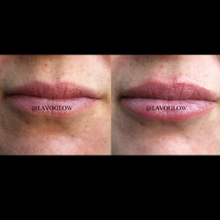 Load image into Gallery viewer, Lavo Lip Booster